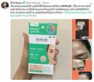 Karmart Skynlab+ Acne Patch : สกินแล็บ แผ่นแปะสิว x 1 ชิ้น