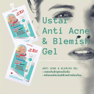 Ustar Anti Acne & Blemish Gel #30531 : ยูสตาร์ เจลแต้มสิว ควบคุมความมัน